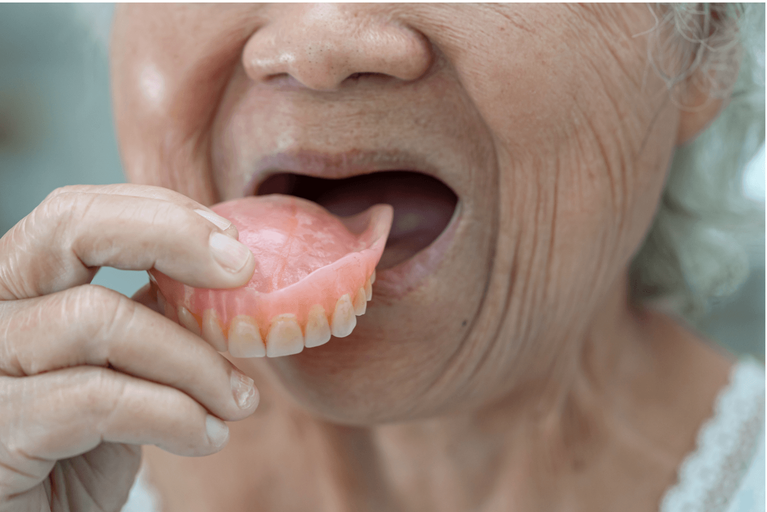 Removable Partial Denture and Full Denture