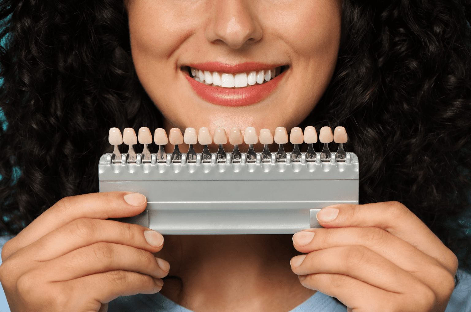 Veneers Treatment